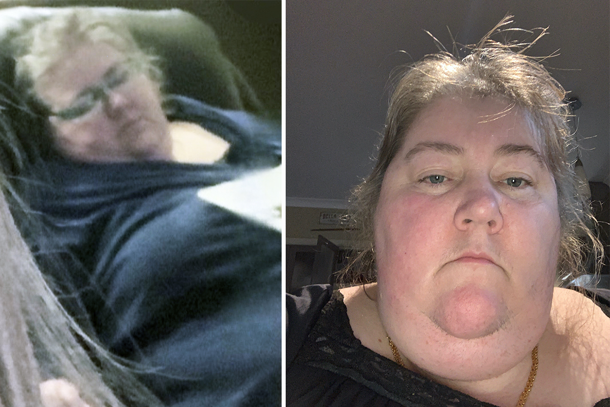 770lb Woman Who Was Housebound Sheds a Whopping 500lb—She's Now Unrecognizable