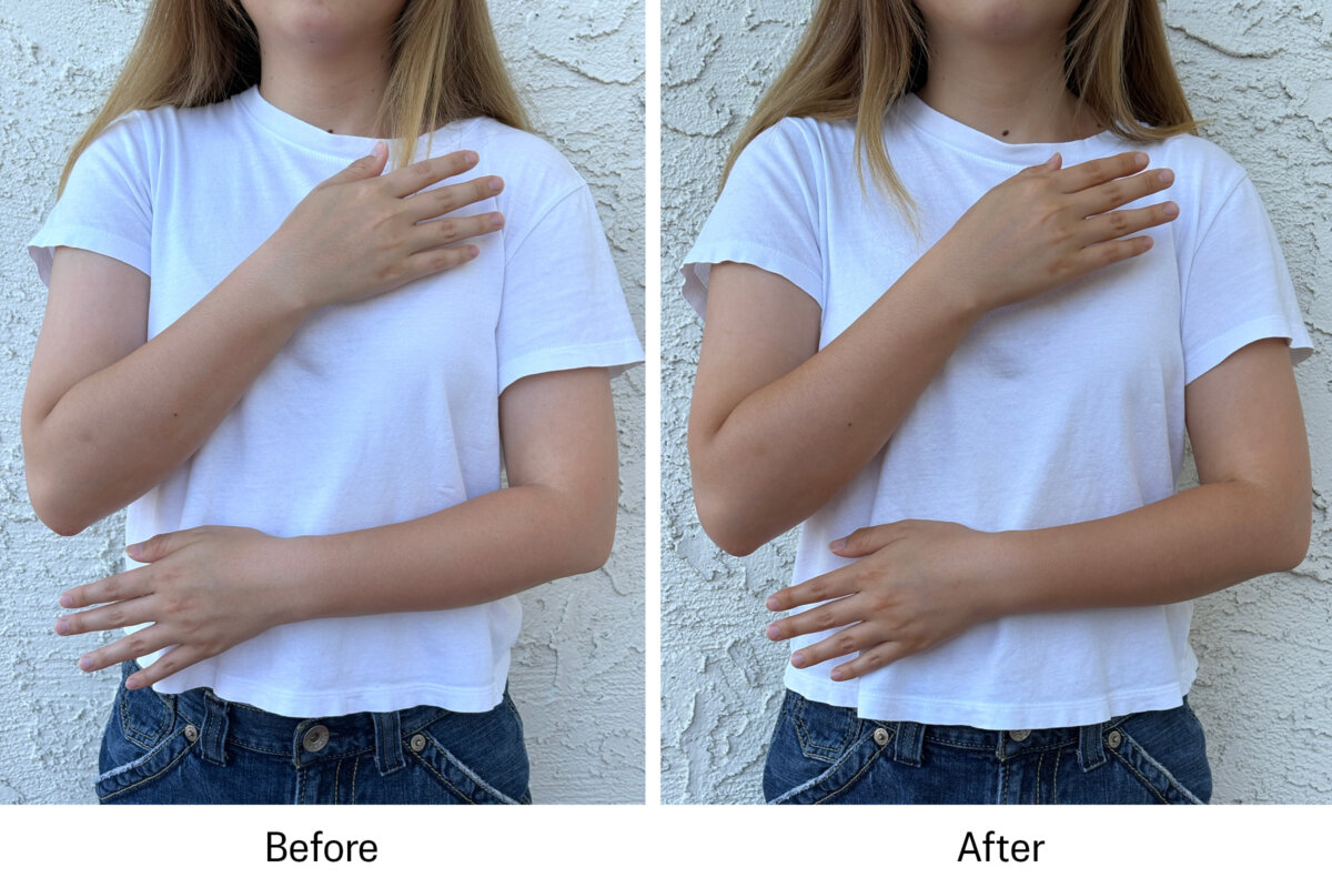 before and after of the arms using lux unfiltered tanning body cream