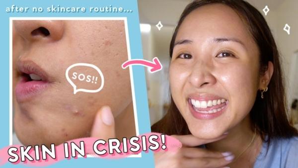 When Nothing Else Works: 3 Easy 'SOS' Steps for All Skin Types!