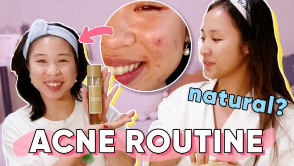 Acne-Prone Routine With My Sister | Gen Z vs. Millennial Skincare