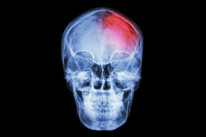 What Makes Us Conscious?