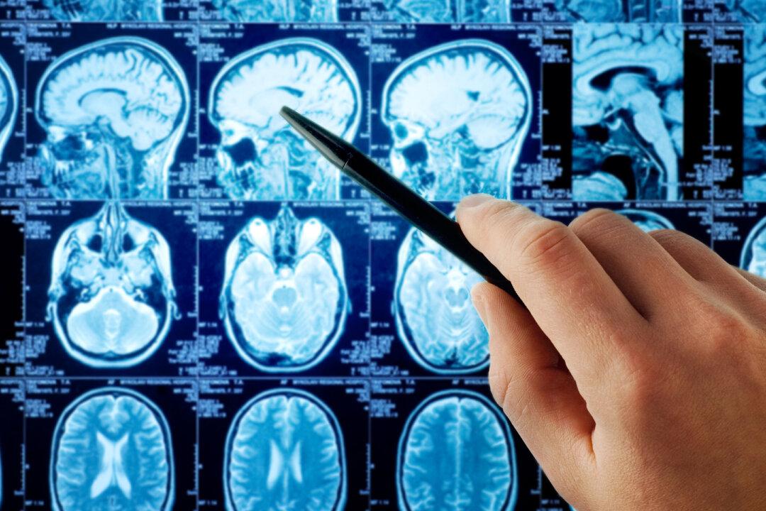 New Brain Cancer Drug Passes Phase One of Trial