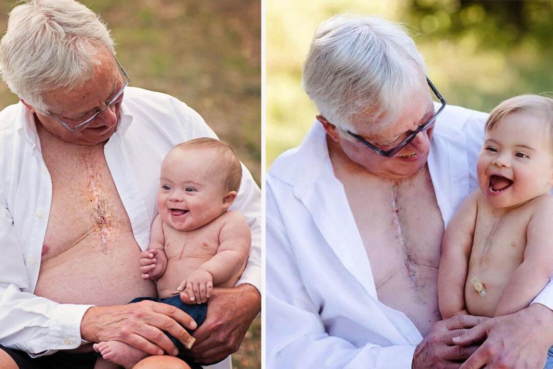 Grandpa and His Grandson With Down Syndrome Share ‘Heartiversary’ and Matching Scars