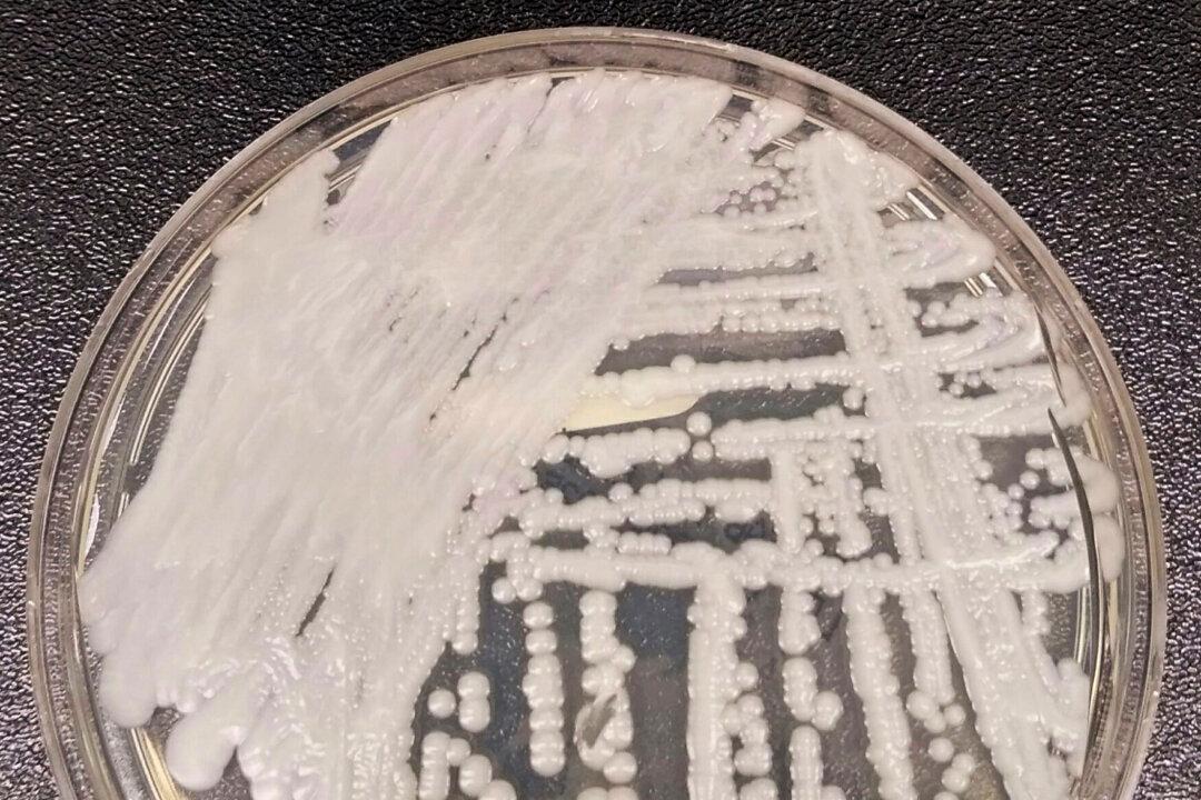‘Superbug’ Fungus Spread in Two Cities, Health Officials Say
