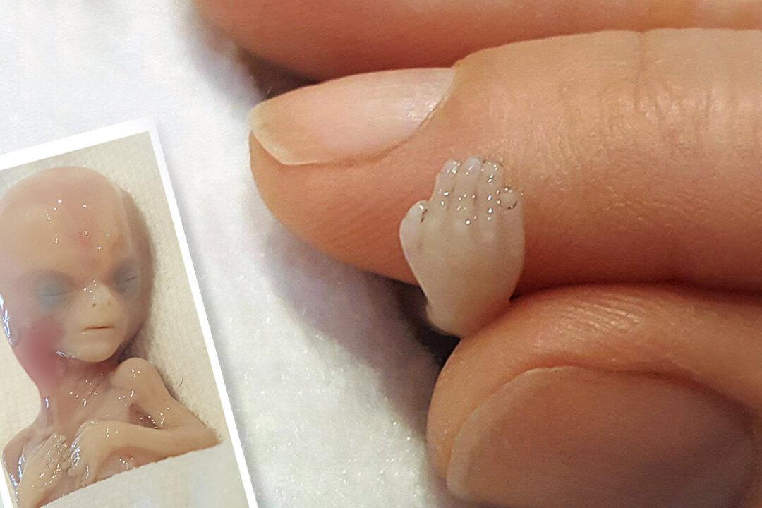 Photos of ‘Perfectly Formed’ 14-Week Miscarried Baby Are Saving Lives: ‘He Was Not Medical Waste’