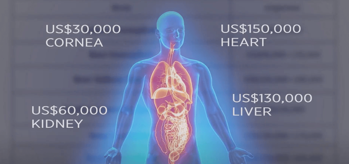 An image from video footage featured in "Medical Genocide: Hidden Mass Murder in China's Organ Transplant Industry" about China's corrupt organ harvesting industry. (EpochTV)