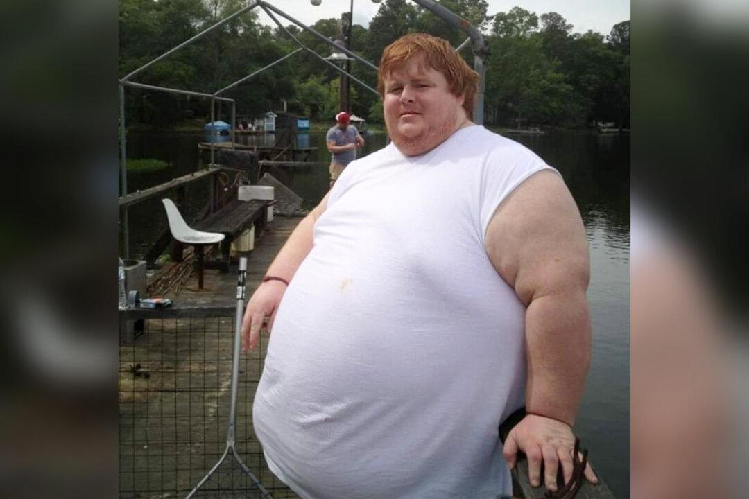 Obese Young Man Who Weighed 820 Pounds Now Unrecognizable After Dropping 600