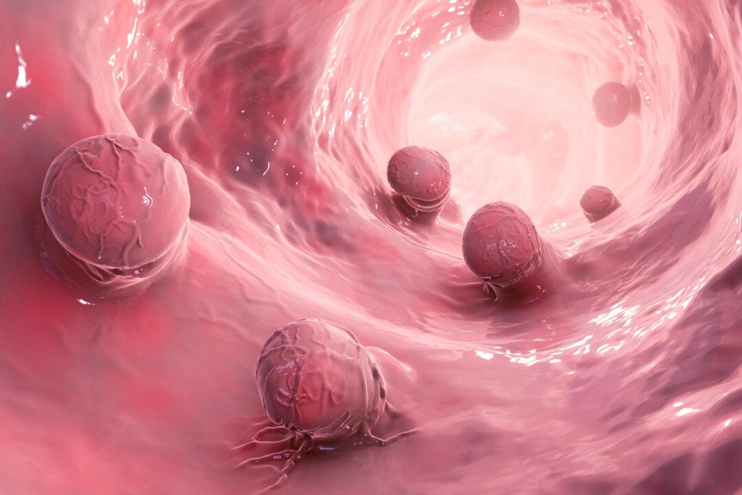 Stiff Colon Tissue Linked to Rising Cancer Cases in Young Adults